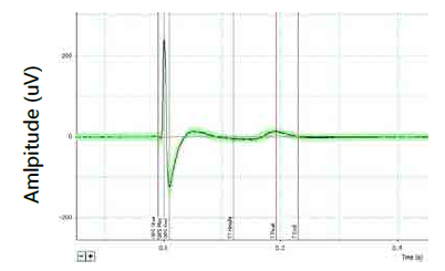 人iPS细胞来源的心肌细胞，用于高通量分析                              ReproCardio 2