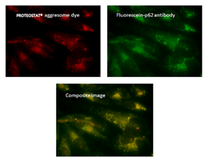 PROTEOSTAT® Aggresome detection kit                              蛋白聚集小体检测试剂盒