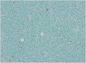 细胞凋亡in situ检测试剂盒Wako                              Apoptosis in situ Detection Kit Wako