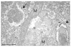 抗LC3（克隆号：LC3・1703）单克隆抗体                              Anti LC3 (Clone: LC3-1703) monoclonal antibody