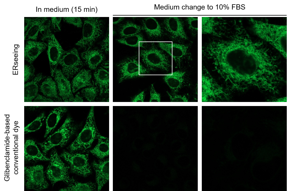 ERseeing ＜Endoplasmic Reticulum Green＞                              对活细胞影响少，适于长时间成像的ER染色试剂