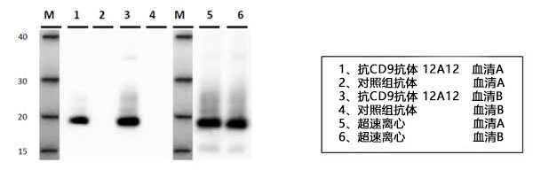 外泌体分离用单克隆抗体 Anti CD9，CD63，CD81