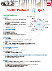 SeeDB2                              深层组织的高分辨率·高亮度分析