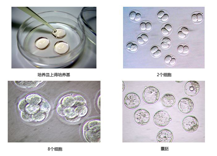 通用冻存试剂和培养基                              Mouse General Freezing and Culture Medium