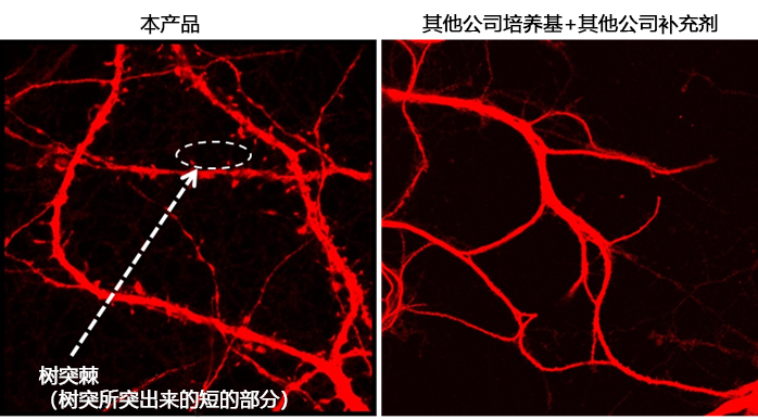 2915565169251235.jpg 神经细胞用培养基
