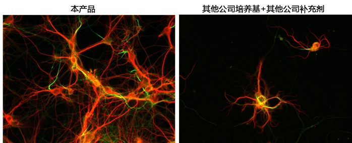 神经细胞用培养基