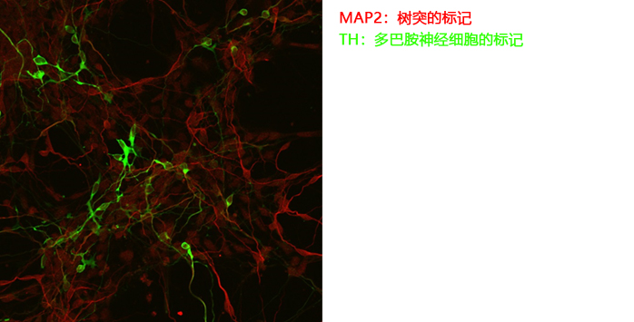 2915565179196822.jpg 神经细胞用培养基
