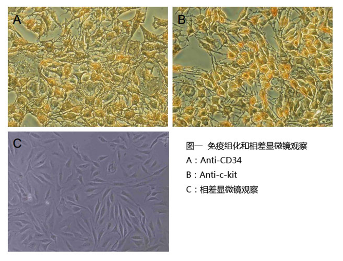 胃肠道间质瘤-T1 培养套装                              GIST-T1 Culture Kit