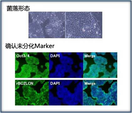 玻璃粘连蛋白（20-398aa），人，重组体，溶液