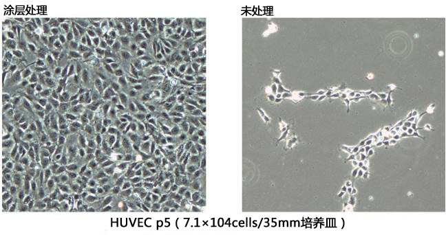 cellnest人Ⅰ型重组胶原蛋白肽                              cellnest, recombinant peptide based on human collagen type