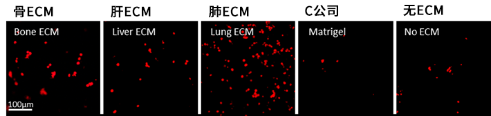 IN SITE™ Metastasis Kit                              ​转移性癌症/癌症药物研发的培养基质试剂盒