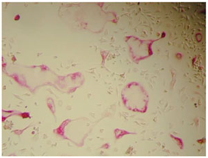 抗酒石酸酸性磷酸酶 TRAP 染色试剂盒                              TRAP Staining Kit