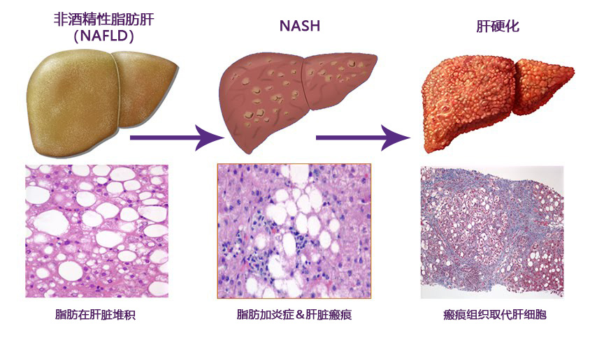 NASH细胞核受体                              非酒精性脂肪肝（NASH/NAFLD）研究用核受体