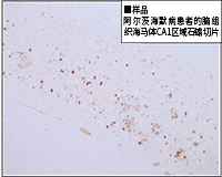 Tau 抗体系列                              阿尔茨海默病相关抗体