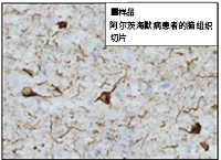 Tau 抗体系列                              阿尔茨海默病相关抗体