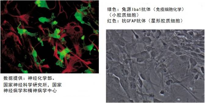 兔源Iba1抗体，无标签                              Anti Iba1, Rabbit