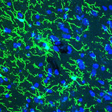 抗Iba1, 重组兔源单克隆抗体（6A4）                              Anti Iba1, Rabbit Monoclonal Antibody (6A4), recombinant