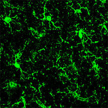 抗Iba1, 重组兔源单克隆抗体（6A4）                              Anti Iba1, Rabbit Monoclonal Antibody (6A4), recombinant