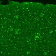 抗Iba1, 重组兔源单克隆抗体（6A4）                              Anti Iba1, Rabbit Monoclonal Antibody (6A4), recombinant