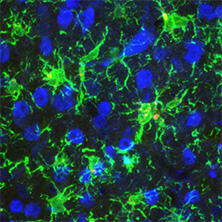 抗Iba1, 重组兔源单克隆抗体（6A4）                              Anti Iba1, Rabbit Monoclonal Antibody (6A4), recombinant