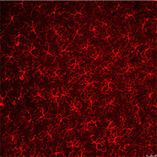 抗Iba1, 重组兔源单克隆抗体（6A4）                              Anti Iba1, Rabbit Monoclonal Antibody (6A4), recombinant