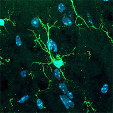 抗Iba1, 重组兔源单克隆抗体（6A4）                              Anti Iba1, Rabbit Monoclonal Antibody (6A4), recombinant