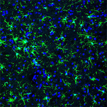 抗Iba1, 重组兔源单克隆抗体（6A4）                              Anti Iba1, Rabbit Monoclonal Antibody (6A4), recombinant