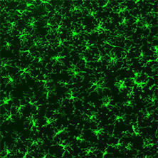 抗Iba1, 重组兔源单克隆抗体（6A4）                              Anti Iba1, Rabbit Monoclonal Antibody (6A4), recombinant