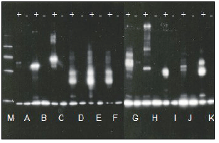 泛素化试剂盒                              Ubiquitinylation kit