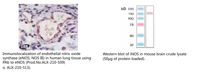 神经胶质原纤维酸性蛋白单克隆抗体（EB4）                              Glial fibrillary acidic protein, mAb (EB4)