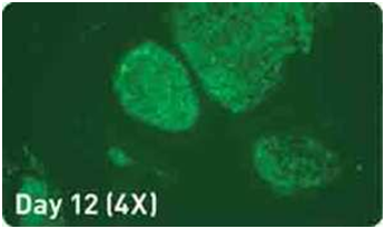 microRNA 增强试剂盒                              microRNA Booster Kit