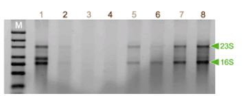 ISOIL for RNA                              从土壤提取RNA试剂盒