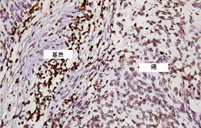 AMPIVIEW™ RNA 探针