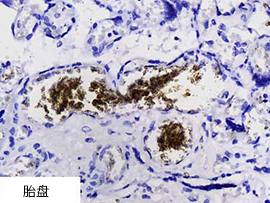 AMPIVIEW™ RNA 探针